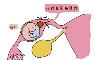 宫外孕最喜欢你这样的女性.......png