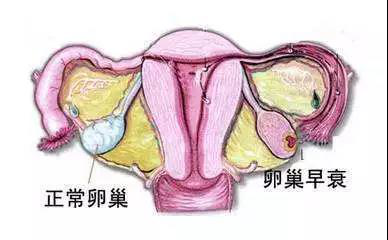 这个月怎么还没来大姨妈？ 99%可能是.......png